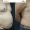 tummytuck-04-1400x788